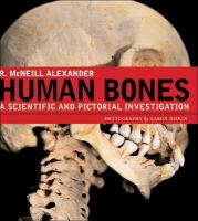Human_bones