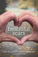 Beautiful_scars